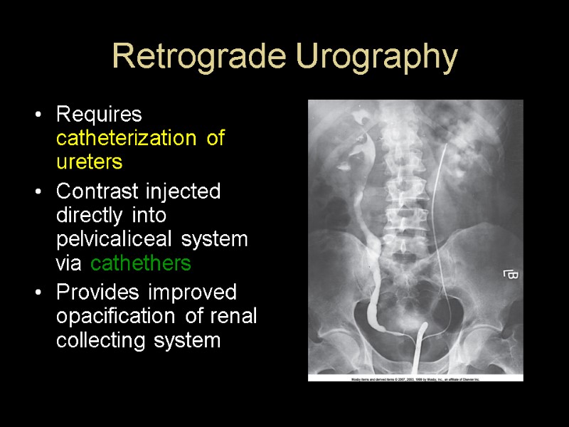 Retrograde Urography Requires catheterization of ureters Contrast injected directly into pelvicaliceal system via cathethers